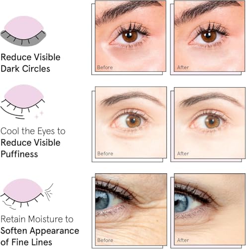 grace & stella Award Winning Under Eye Mask - Travel Essentials - Birthday Gifts for Women - Gel Eye Patches for Dark Circles, Puffy Eyes, Wrinkles, Undereye Bags - Vegan - Self Care (24 Pairs, Gold) - Image 2